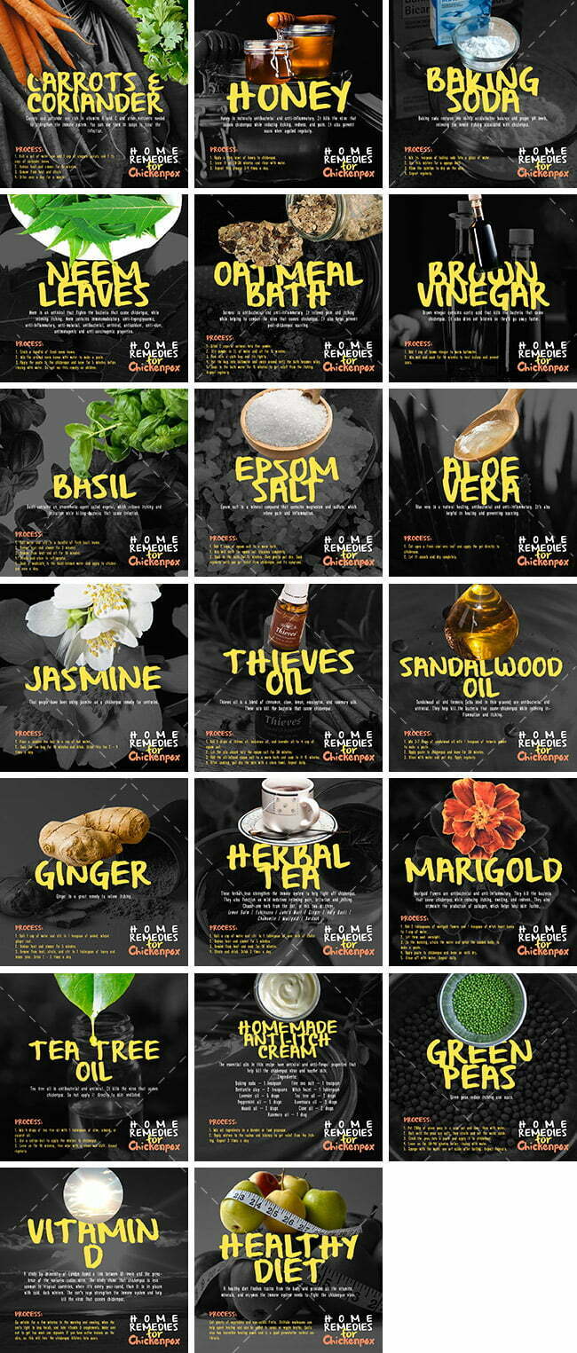 Home Remedies For Chickenpox Bundle Healthinomics